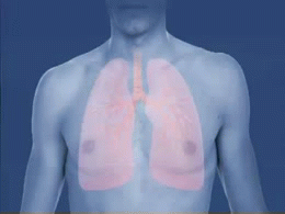 Archivo:Asthma attack-airway (bronchiole) constriction-animated