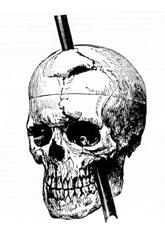 Archivo:Phineas gage - 1868 skull diagram