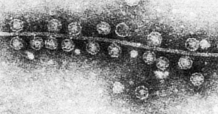 Bacteriophage Qβ attached to sex pilus of E. coli
