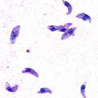 Archivo:Toxoplasma gondii tachy