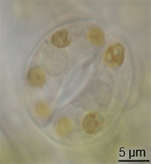 Archivo:Tomato stoma observed through immersion oil