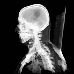 Archivo:3d CT scan animation
