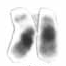 Archivo:Human male karyotpe high resolution - Chromosome 21 cropped