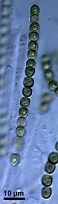 Archivo:Hypocrea virens