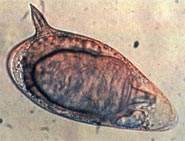 Archivo:Schistosoma mansoni