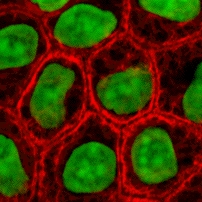 Archivo:Epithelial-cells