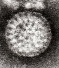 Archivo:Flewett Rotavirus