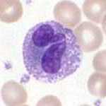 Eosinófilo, célula de la sangre.