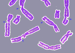 Daños en el ADN, mostrados como roturas en los cromosomas.