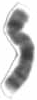 Human male karyotpe high resolution - X chromosome cropped.png