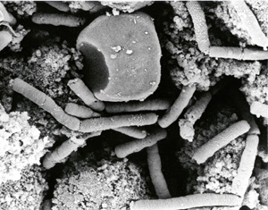 Archivo:AnthraxBacteria