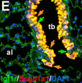 Cel Clara Bronq-distal