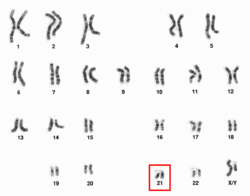 Human male karyotpe high resolution - Chromosome 21.png