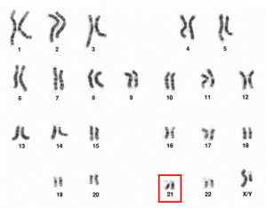 Archivo:Human male karyotpe high resolution - Chromosome 21