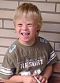 Boy with Down Syndrome