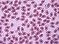Chickenrbc1000x