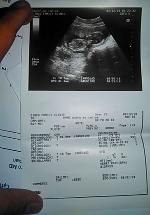 Archivo:Ultrasound result