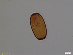 Collection Penard MHNG Specimen 46-2-1 Amphitrema flavum