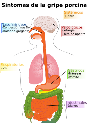 Archivo:Diagram of swine flu symptoms-es