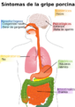 Diagram of swine flu symptoms-es