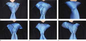 Archivo:Tie-knot-examples