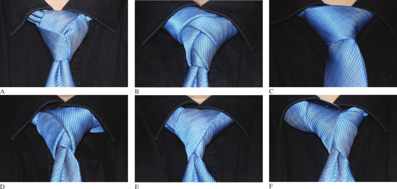 Tie-knot-examples