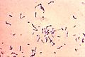 Corynebacterium diphtheriae Gram stain