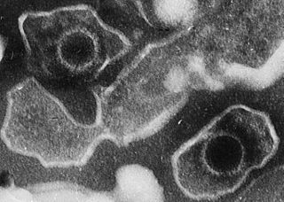 Epstein Barr Virus virions EM 10.1371 journal.pbio.0030430.g001-L.JPG