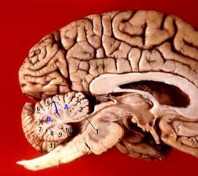 Archivo:Human brain midsagittal view description