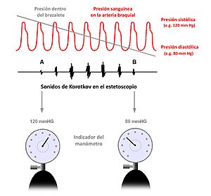 Archivo:Explicación de cómo se mide la presión sanguínea basado en los sonidos de Korotkow