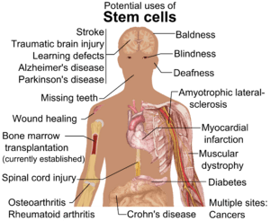 Archivo:Stem cell treatments