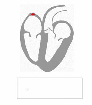Archivo:ECG Principle fast