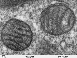 Archivo:Mitochondria, mammalian lung - TEM