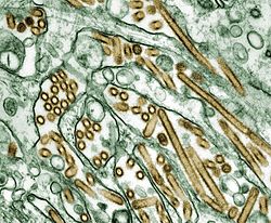 Archivo:Colorized transmission electron micrograph of Avian influenza A H5N1 viruses
