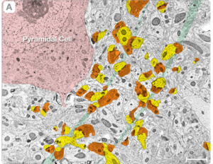 Archivo:Neuropilo Corteza cerebro