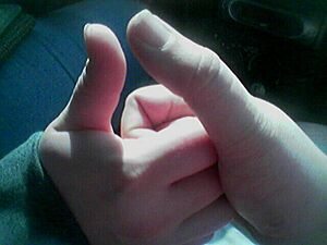Archivo:Thumb Wrestling