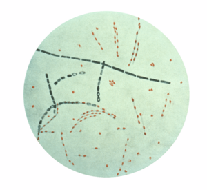 Archivo:Bacillus anthracis