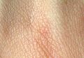 Human skin structure