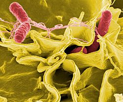 Salmonella Bacteria (5613656967).jpg