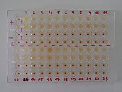 Archivo:TPHA test on microplate wells