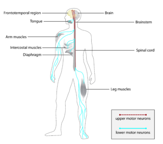 ALS Affected neurons and muscles.png
