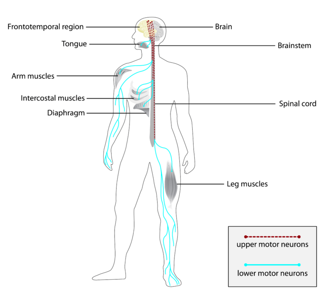 ALS Affected neurons and muscles