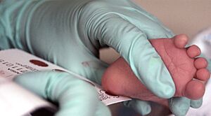 Archivo:Phenylketonuria testing