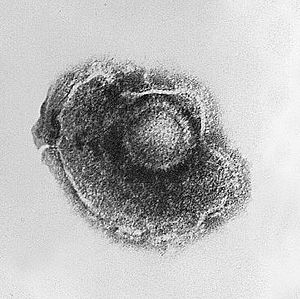 Archivo:Varicella (Chickenpox) Virus PHIL 1878 lores