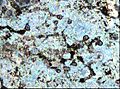 Biofilm parodontitis 100x