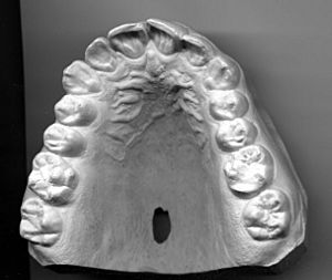 Archivo:Upper Jaw Dentition