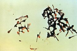 Clostridium tetani.jpg