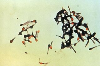 Clostridium tetani.jpg