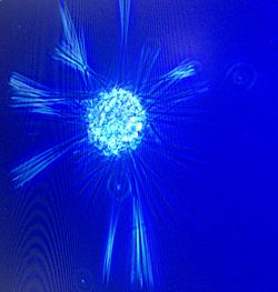 Sticholonche- unicellular eukaryote, radiolarian.jpg