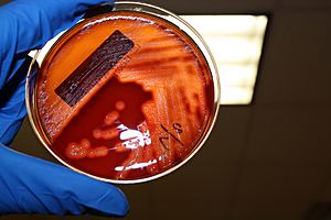 Archivo:Streptococcus pyogenes agar sangre